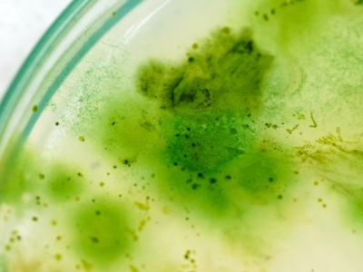 Close-up of a petri dish showing uneven patches of green microbial or algal growth on nutrient medium.