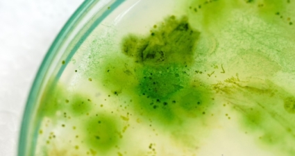 What are cyanobacteria?